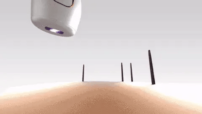 Mini Laser Hair Removal Portable / جهاز إزالة الشعر بالليزر المصغر المحمول